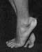 biron_feet085